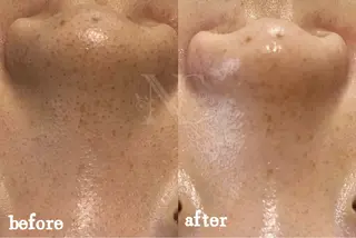 Nature Souce毛穴専門店のその他イメージ