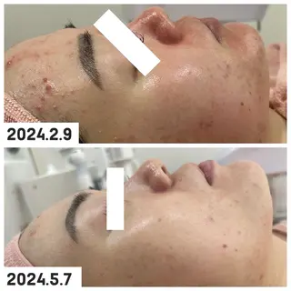 【現役看護師】高来 笑子のエステ・リラクイメージ