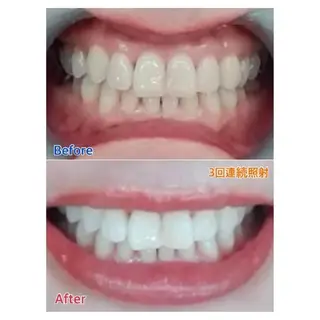 M渋谷 ホワイトニングのエステ・リラクイメージ