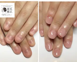 メンズ ネイル 深爪矯正専門店　ネイルサロン　トイロ所属・ネイルサロン トイロのネイルデザイン