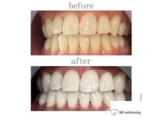 メンズ NAホワイトニング所属・NAホワイトニング /自由が丘のエステ・リラクイメージ