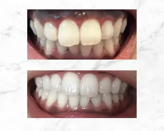 セルフホワイトニングビューティー三川店所属・中村 江梨香のその他イメージ