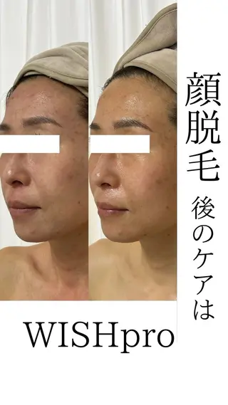 脱毛専門 ページ/Bloomのエステ・リラクイメージ