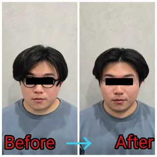 小顔矯正・美容鍼 FLOW鍼灸整体院のエステ・リラクイメージ