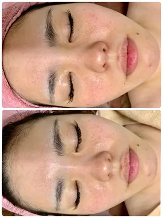 ハーブピーリングMB eautySalonのエステ・リラクイメージ