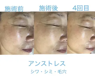 セラピエール 石川のエステ・リラクイメージ