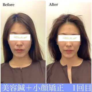 ハリサロンドオフ 美容鍼灸×小顔整体のエステ・リラクイメージ