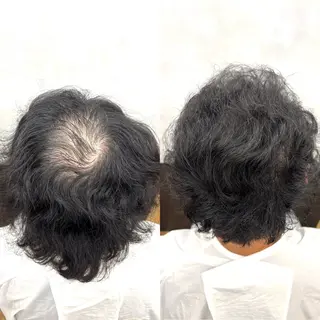 メンズ 薄毛専門美容師 和久井博のその他イメージ