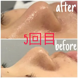 アルカンジュ~archange~所属・痩身/毛穴洗浄/脱毛 アルカンジュのエステ・リラクイメージ