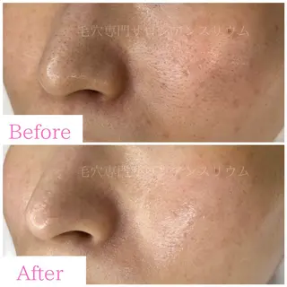 毛穴ケア専門サロンアンスリウム所属・茨城土浦 つくば毛穴 ケア専門サロンのエステ・リラクイメージ