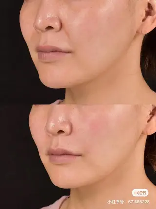 ネイル aliaハーブ水光店 エステティシャン募集のエステ・リラクイメージ