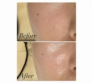 ROR Akariのエステ・リラクイメージ