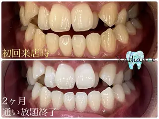 札幌ホワイトニング ラディアンス札幌駅店のその他イメージ