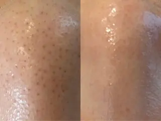 【都度払い脱毛】毛穴 専門サロン  馬車道のエステ・リラクイメージ