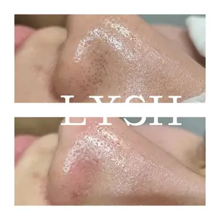 エステサロン LYSHのその他イメージ