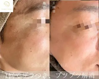 ハーブピーリング専門 グランディール　武内のエステ・リラクイメージ