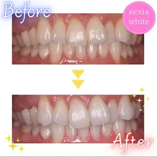 メンズ nanami -ホワイトニングのその他イメージ