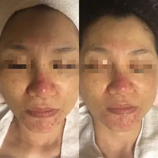 エスカル ボーテのエステ・リラクイメージ