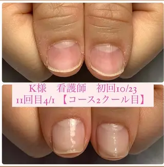 ネイル 自爪育成/深爪矯正 mikiのネイルデザイン