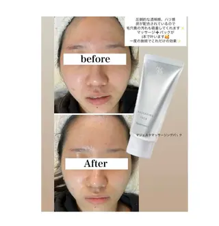 ROR Akariのエステ・リラクイメージ