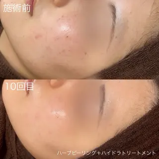 lulula ricoのエステ・リラクイメージ