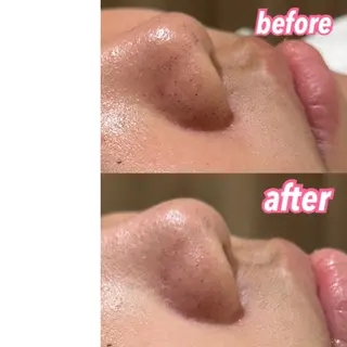 pansy フェイシャルエステのエステ・リラクイメージ