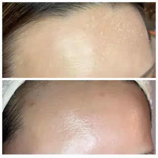 ニキビ/敏感肌/乾燥 Lilyauraのエステ・リラクイメージ