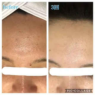 ロング カラー パーマ ヘアアレンジ キッズ ネイル マツエク・マツパ EnsorClair 代表 野口真央のエステ・リラクイメージ