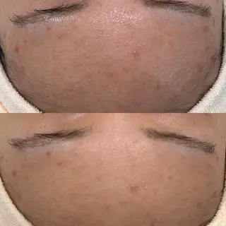 etre - 韓国肌管理 -のエステ・リラクイメージ