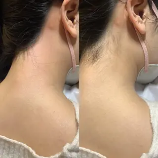 女性のお悩み美容 サロン ヴィーナスのエステ・リラクイメージ