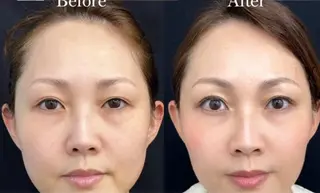 マツエク・マツパ aliaハイフ&水光ジェットサロン所属・aliaハーブ水光店 エステティシャン募集のエステ・リラクイメージ