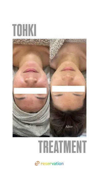 CARNA所属・【肌質改善専門店】 CARNAのエステ・リラクイメージ