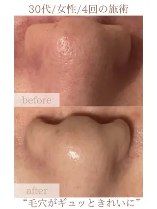 毛穴改善サロン d'Alba大阪住吉のエステ・リラクイメージ