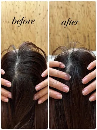 ate'所属・個室ドライヘッドスパ 🍃moriのエステ・リラクイメージ