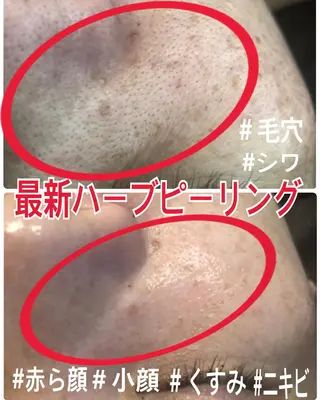 LILIANA ☆YURIのエステ・リラクイメージ