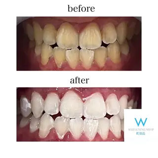 メンズ キッズ ホワイトニング ショップ町田店のその他イメージ