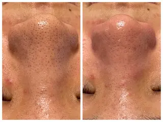 mili mili 岡本のエステ・リラクイメージ