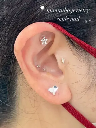 smileskin 京都/meguのその他イメージ