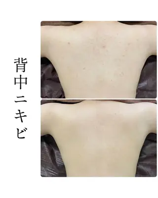 ハーブピーリング専門 BIOEL横浜のエステ・リラクイメージ