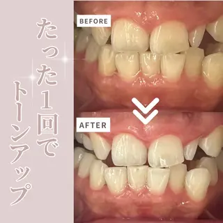 LIBRA自由が丘 ホワイトニングのその他イメージ