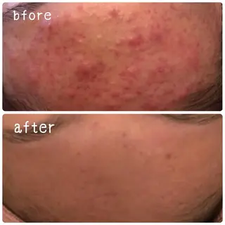 美肌蘇生カウンセラー 横山りえのエステ・リラクイメージ