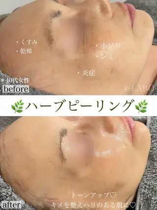 e-LABO こいずみのエステ・リラクイメージ