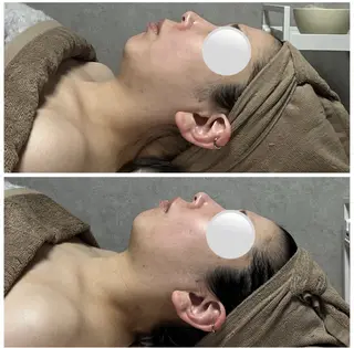 Ｂ&H所属・頭痛肩こり改善/小顔 サロンB&H心斎橋のエステ・リラクイメージ