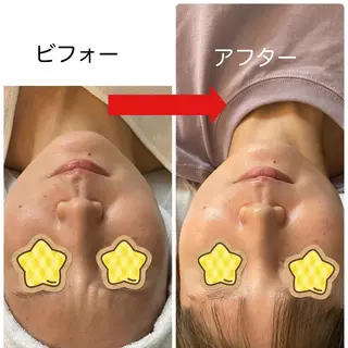 野崎 洋子のエステ・リラクイメージ