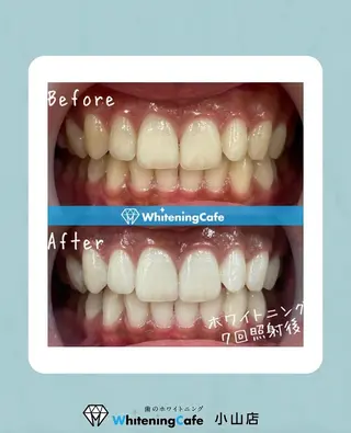 ホワイトニングカフェ 小山店のエステ・リラクイメージ