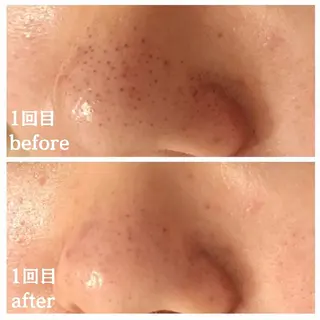 フェイシャル専門サロ ン　ERINのエステ・リラクイメージ