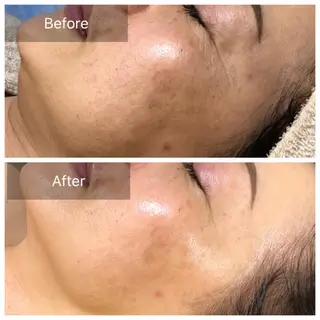 エステサロンきらら 瀧澤のエステ・リラクイメージ