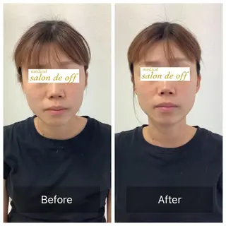 ハリサロンドオフ 美容鍼灸×小顔整体のエステ・リラクイメージ