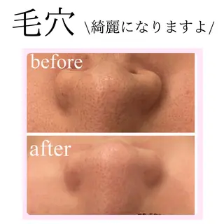 小顔・リフトアップ/ 奈緒美のエステ・リラクイメージ