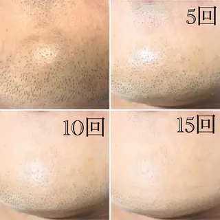 calon hair所属・men's calonのエステ・リラクイメージ